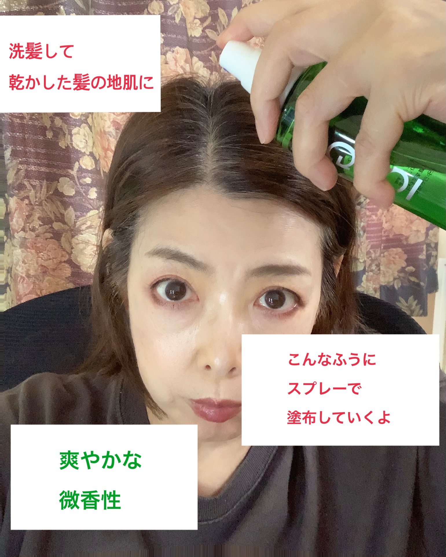 薬用育毛剤HG-101/フローラ/頭皮ローションを使ったクチコミ（3枚目）