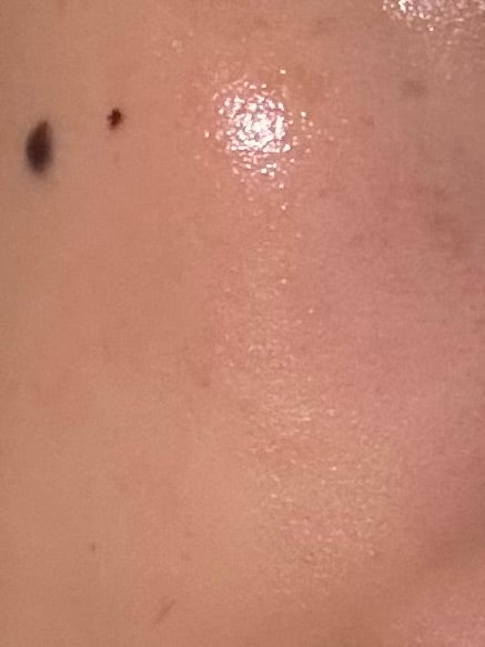 シークレットソリューションPDRNカプセルアンプル/It's skin/美容液を使ったクチコミ(4枚目)