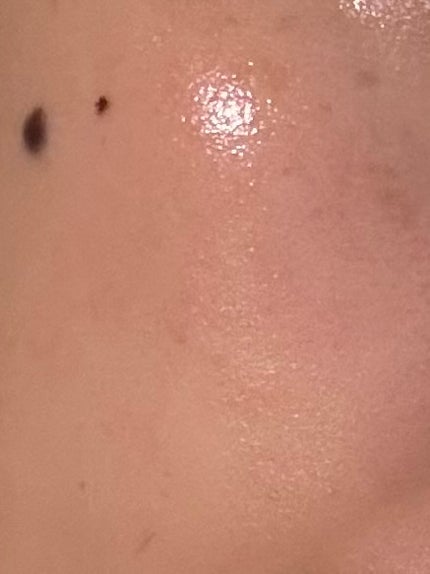 シークレットソリューションPDRNカプセルアンプル/It's skin/美容液を使ったクチコミ(4枚目)