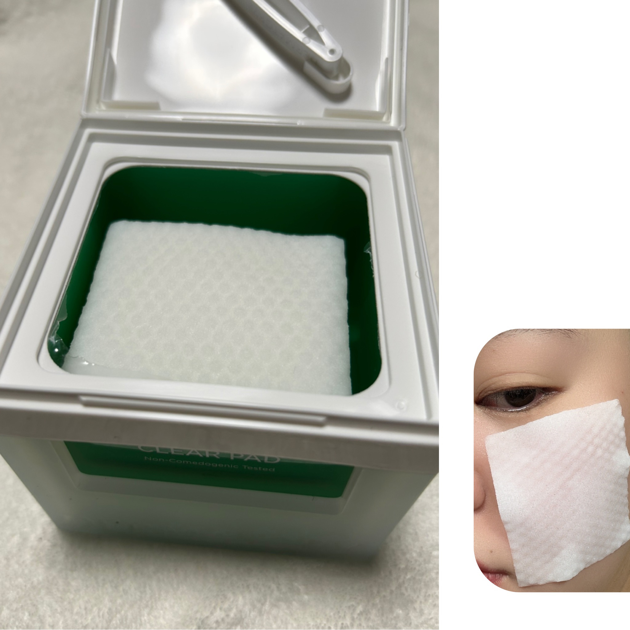 プロ トラブル ポア パッド/Dermatory/トナーパッドを使ったクチコミ（2枚目）