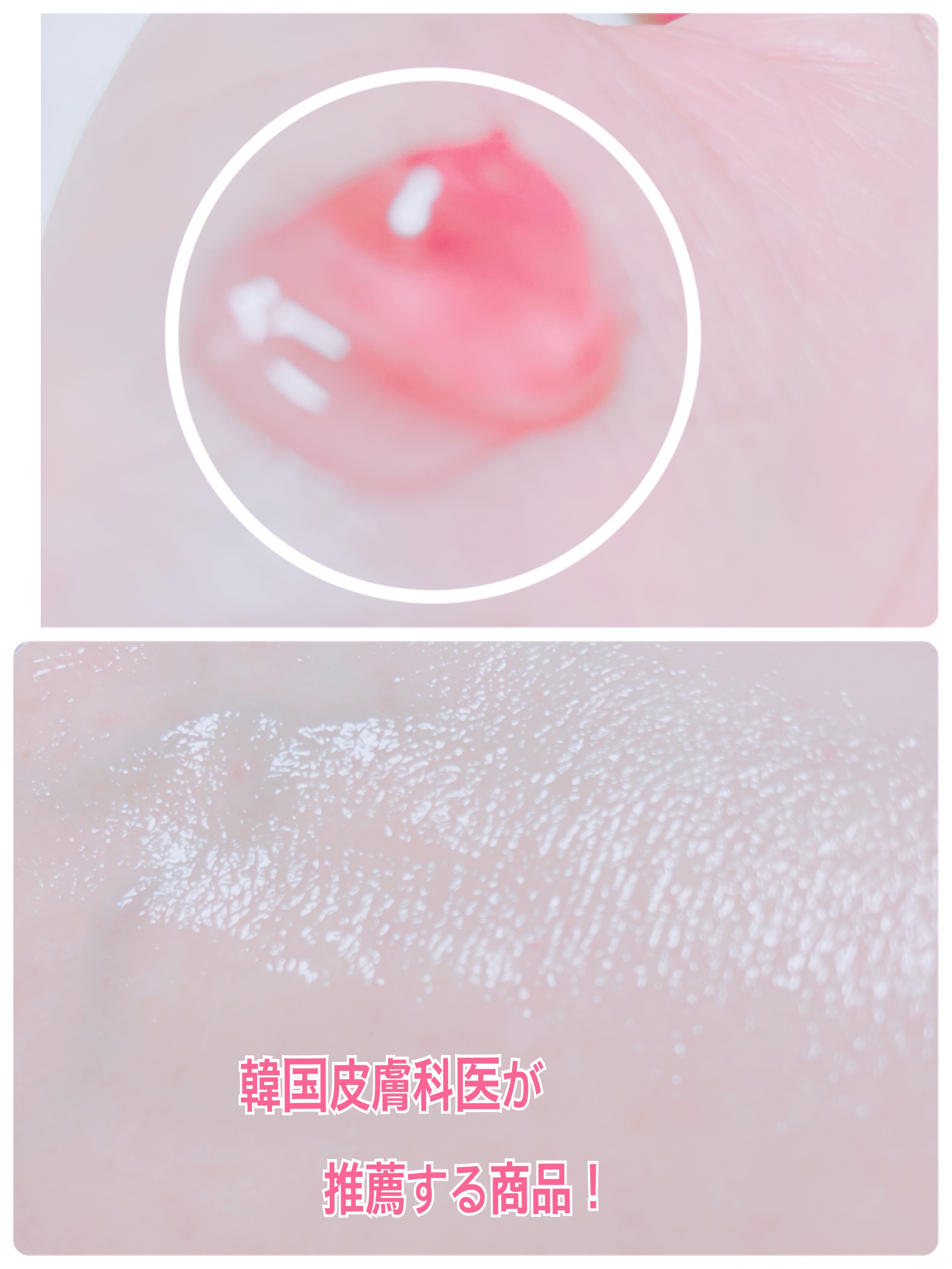 レッドモチセラム30/アレンシア/美容液を使ったクチコミ（3枚目）