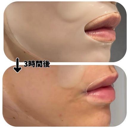 RXザ・アルファアルブチン2 ニキビ跡ケアセラム/COSRX/美容液を使ったクチコミ(5枚目)