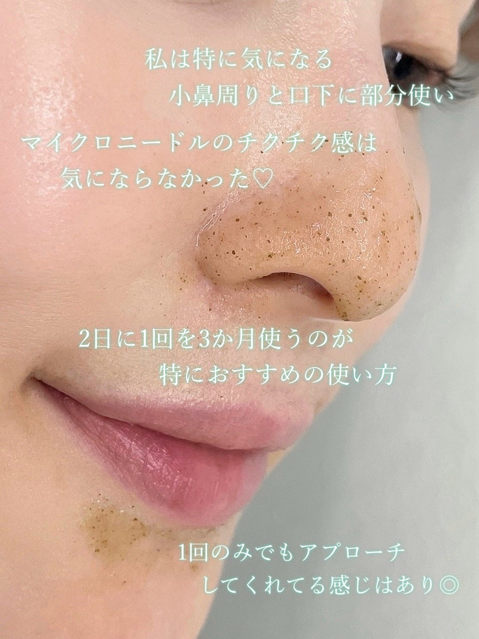 ハーブピーリング/on:myskin/ピーリングを使ったクチコミ(2枚目)