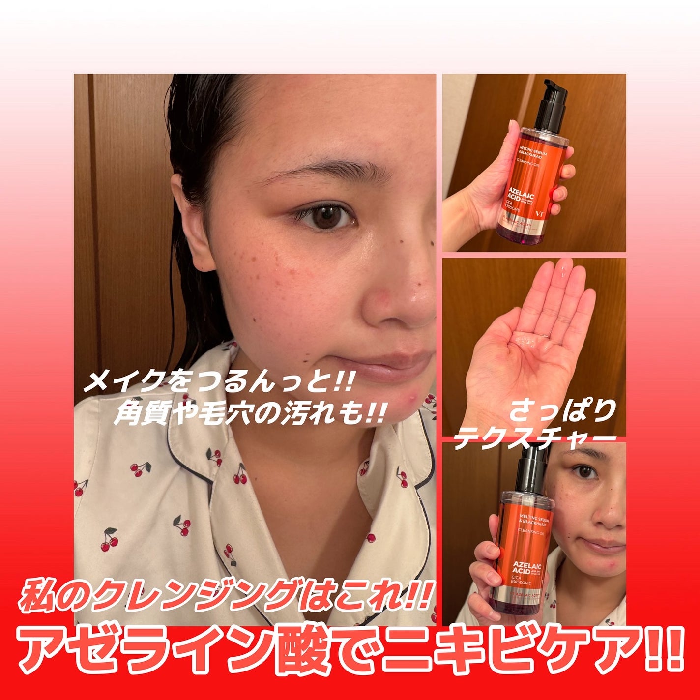 AZケア クレンジングオイル/VT/オイルクレンジングを使ったクチコミ(2枚目)