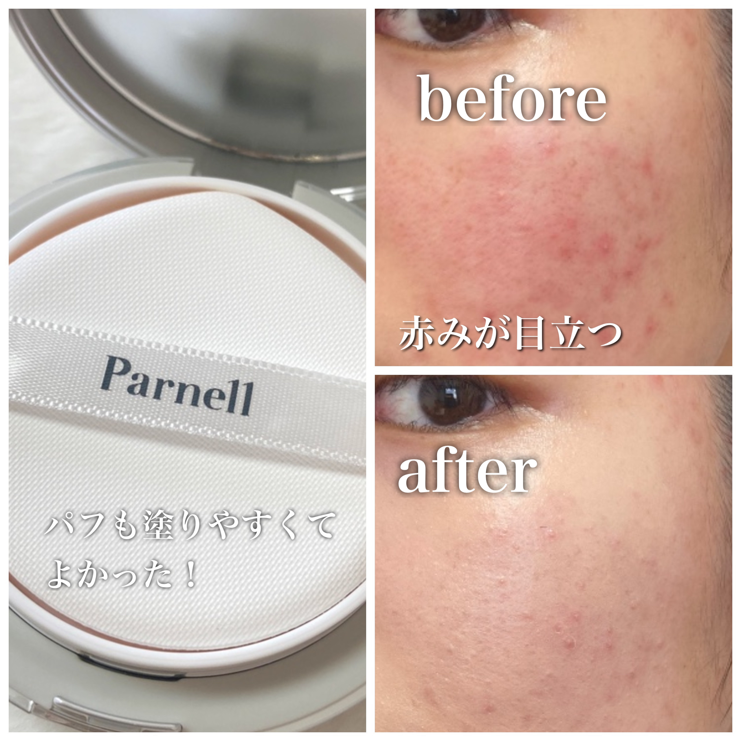 セラム イン ハイグロウ クッション ファンデ No.19/parnell/クッションファンデーションを使ったクチコミ（2枚目）