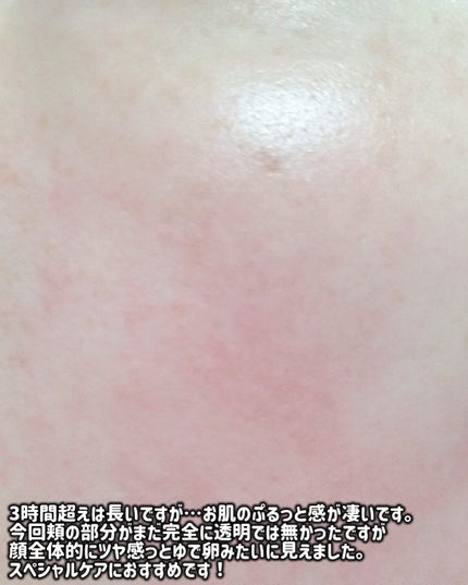 コラーゲンスーパーアブソービングマスク/Milk Touch/シートマスク・パックを使ったクチコミ(6枚目)