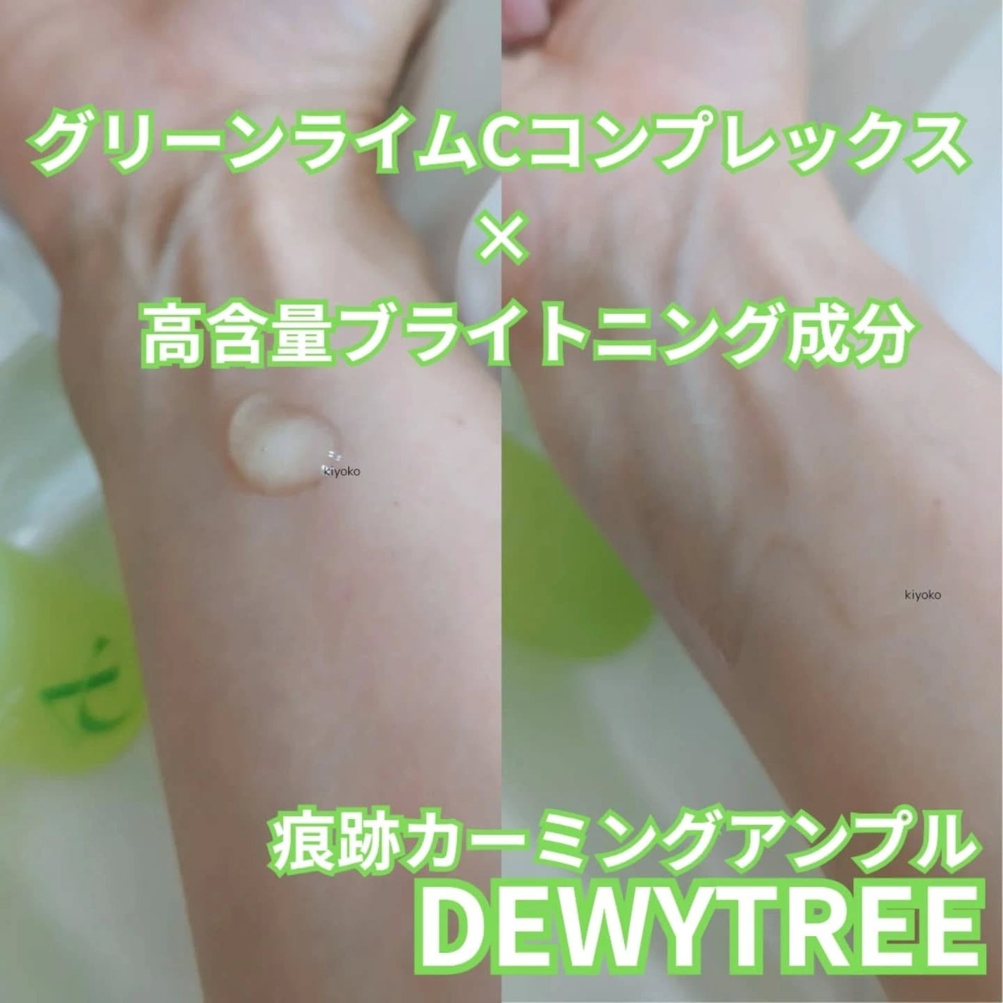 CICAカーミングエッセンス/DEWYTREE/美容液を使ったクチコミ(4枚目)