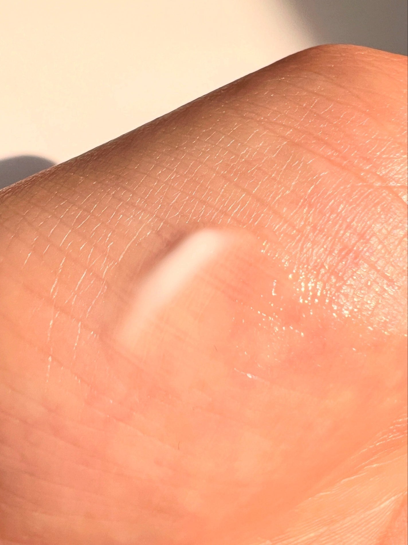 BAKUCHI NEEDLE SHOT DARK CARE AUTO EYE CREAM/LIALUSTER/アイケア・アイクリームを使ったクチコミ(4枚目)