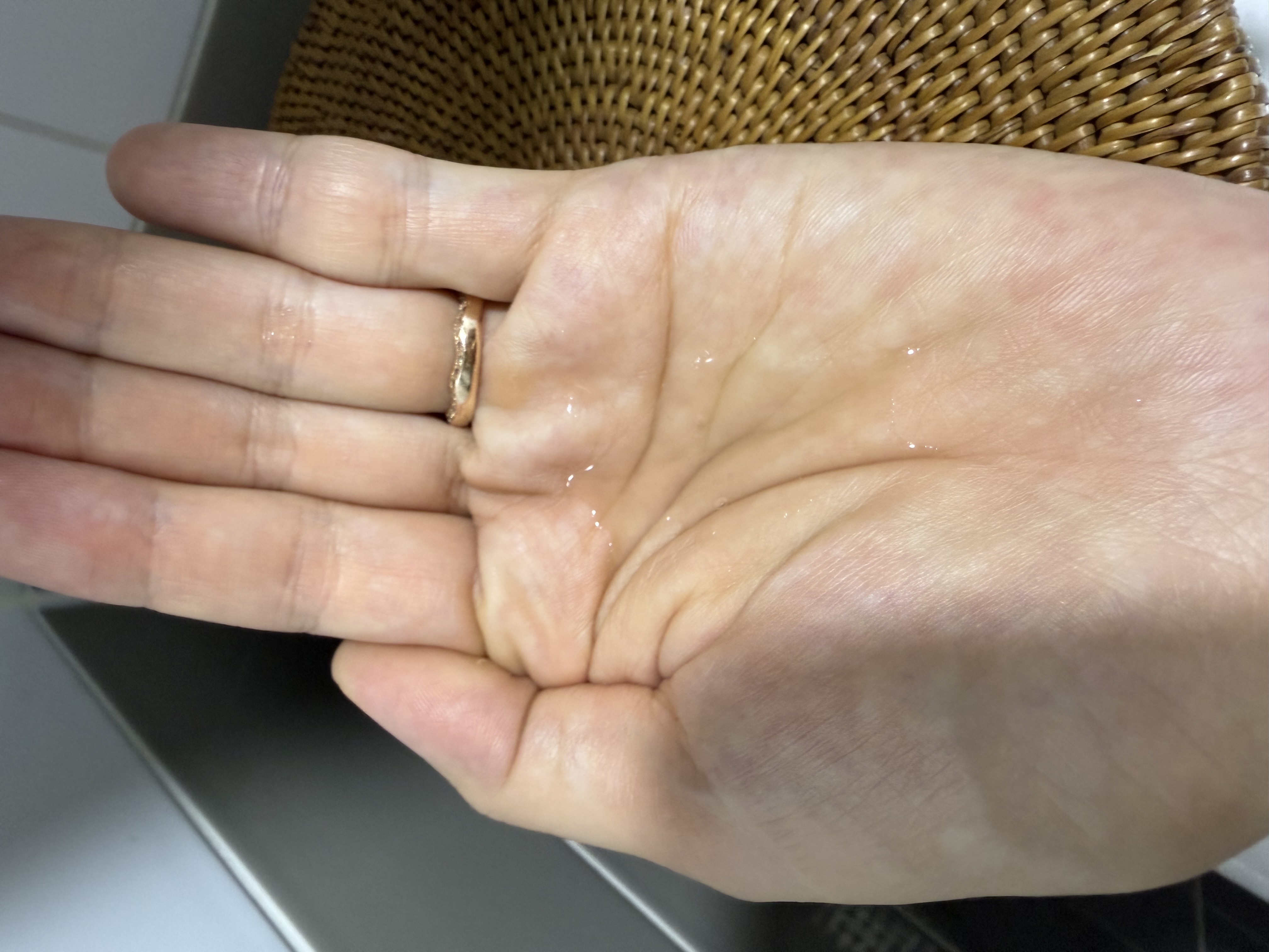 アトバリア365 セラヒアルセラム/AESTURA/美容液を使ったクチコミ（3枚目）