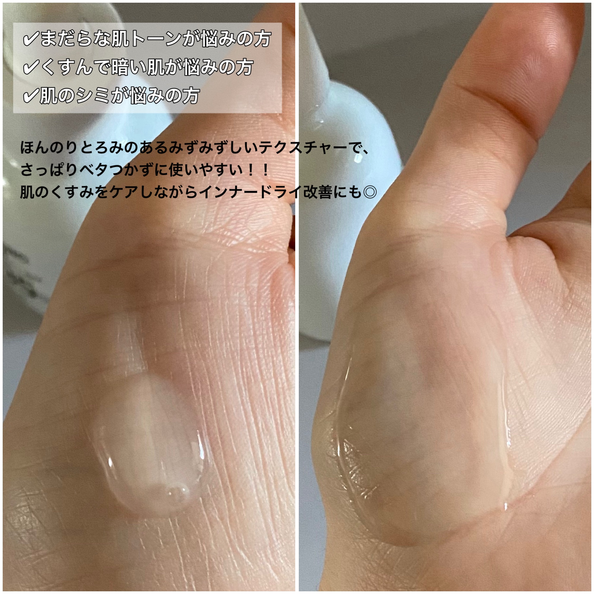 ナイアシンアミド 20.35 ライス ブライトニング セラム/parnell/美容液を使ったクチコミ（3枚目）