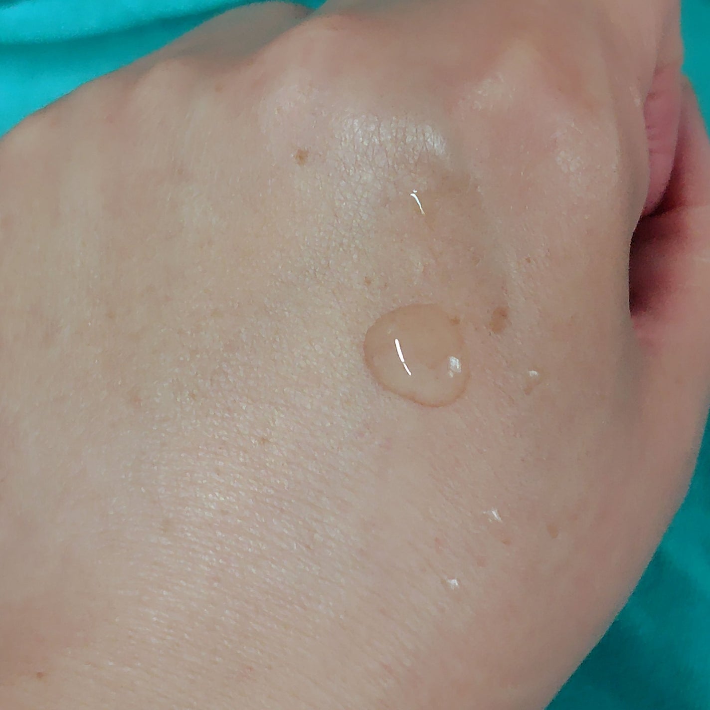 ジェニフィック アルティメ セラム/LANCOME/美容液を使ったクチコミ(3枚目)