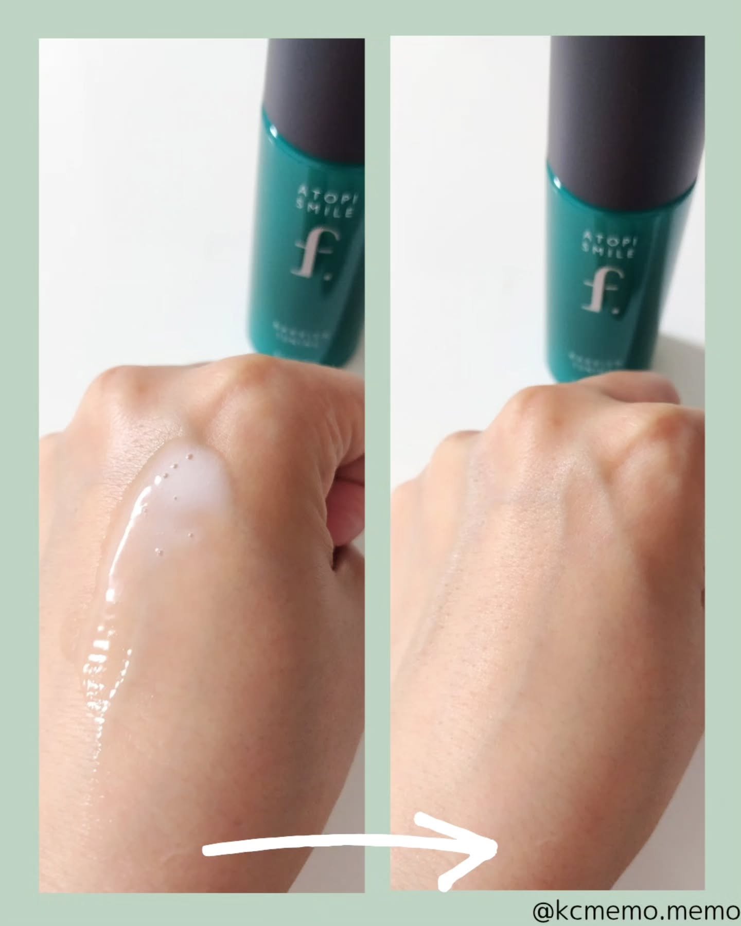 バリアエイドクリーム/ATOPI SMILE f./フェイスクリームを使ったクチコミ（3枚目）