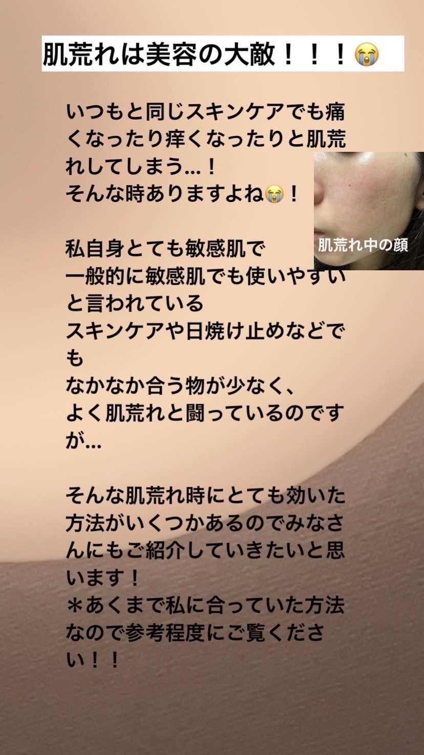 ピュアベール(医薬品)/プロペト/その他を使ったクチコミ（2枚目）