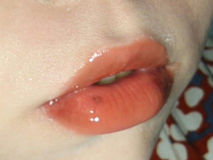 チーク ポップ/CLINIQUE/パウダーチークを使ったクチコミ(5枚目)