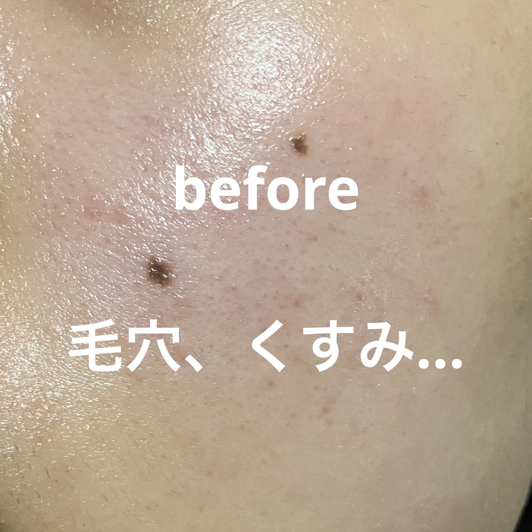 サナ 素肌記念日 薬用スキンケアパウダー ACホワイト【医薬部外品】/素肌記念日/プレストパウダーを使ったクチコミ（3枚目）