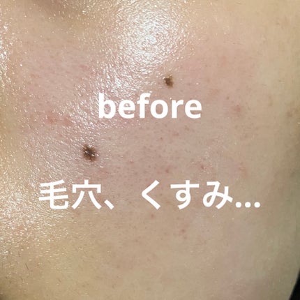 サナ 素肌記念日 薬用スキンケアパウダー ACホワイト【医薬部外品】/素肌記念日/プレストパウダーを使ったクチコミ(3枚目)