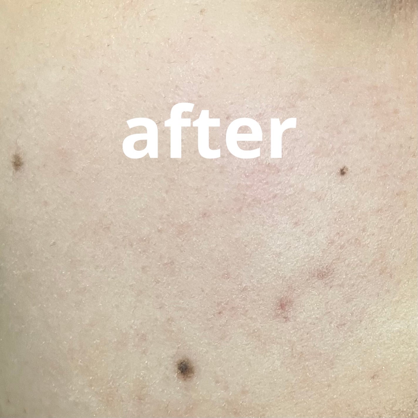 サナ 素肌記念日 薬用スキンケアパウダー ACホワイト【医薬部外品】/素肌記念日/プレストパウダーを使ったクチコミ(4枚目)