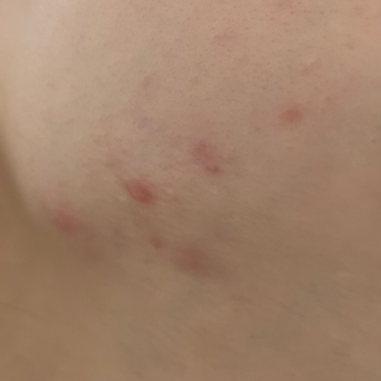 CICA TEATREE 5X SPOT/G9SKIN/その他スキンケアを使ったクチコミ(3枚目)