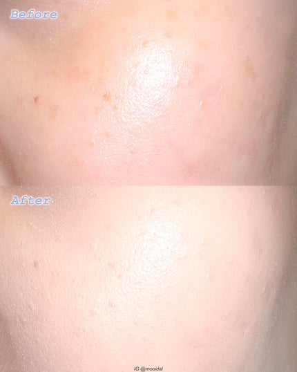 エアーフィットクッション/too cool for school/クッションファンデーションを使ったクチコミ(5枚目)