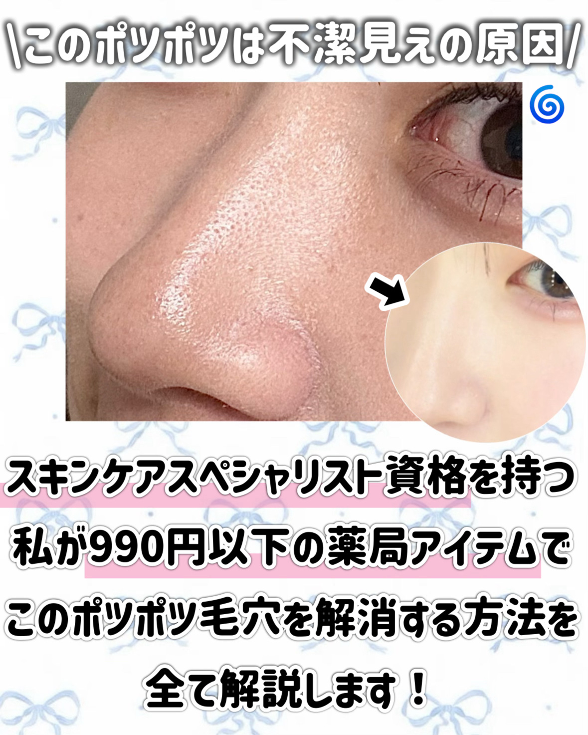 ビタミンＢＯＭＢマスク/クリアターン/シートマスク・パックを使ったクチコミ（2枚目）