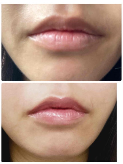 フルーティーグラムティント/Laka/リップティントを使ったクチコミ(1枚目)