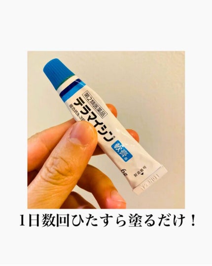 テラマイシン 軟膏(医薬品)/ジョンソン・エンド・ジョンソン/その他を使ったクチコミ(2枚目)