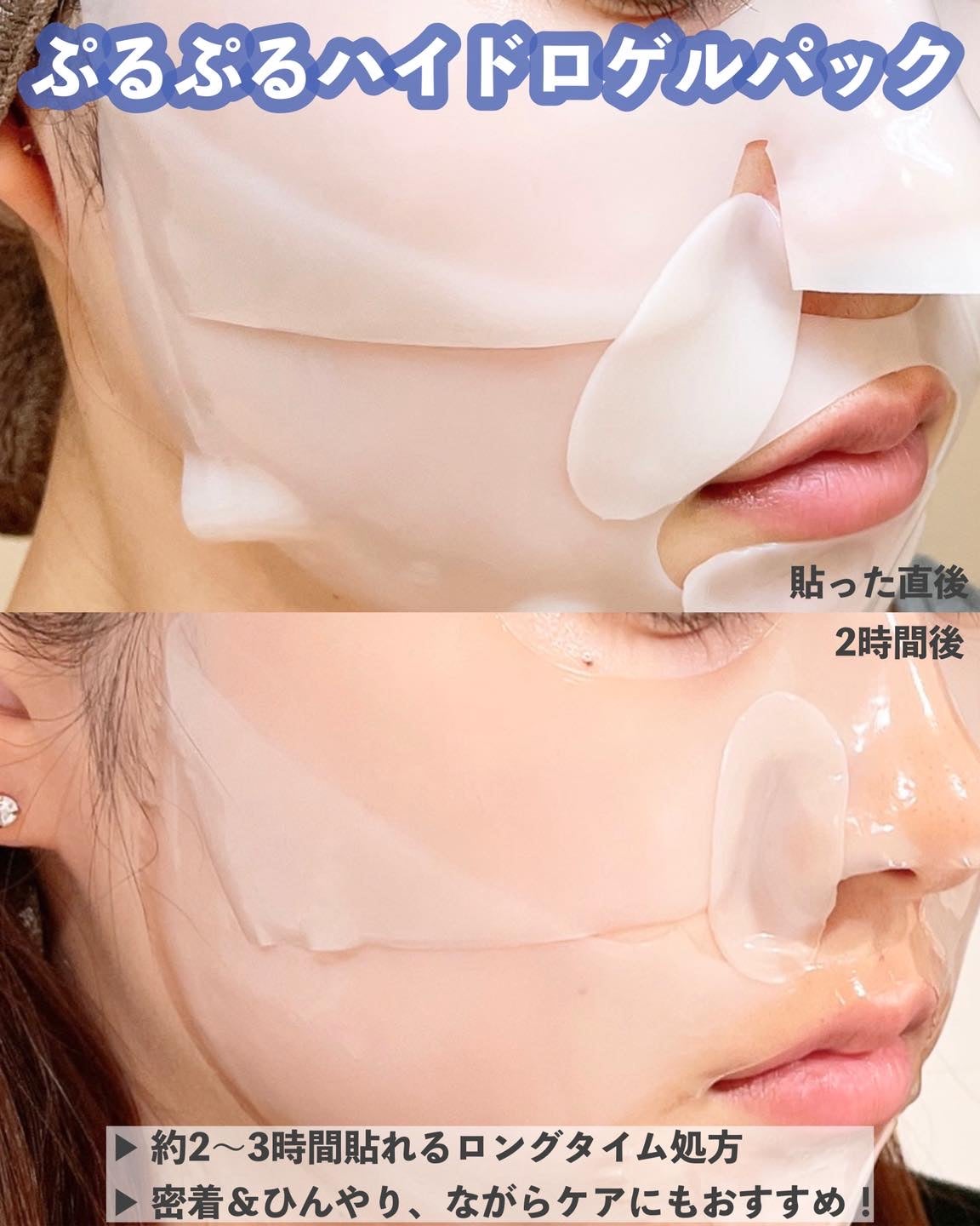 RXザ・アルファアルブチン2 ニキビ跡ケアセラム/COSRX/美容液を使ったクチコミ(4枚目)