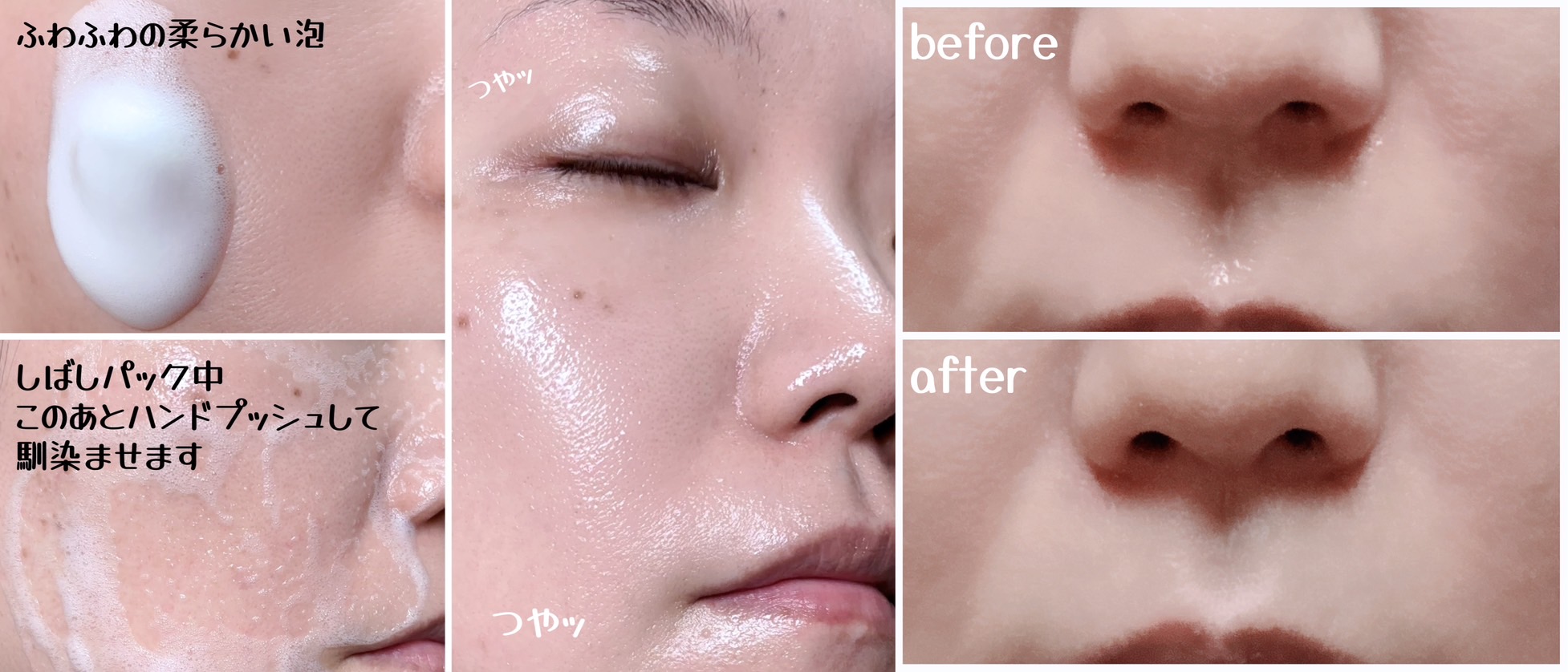 PDRNコラーゲンバブルセラム/CELORABY/美容液を使ったクチコミ（3枚目）