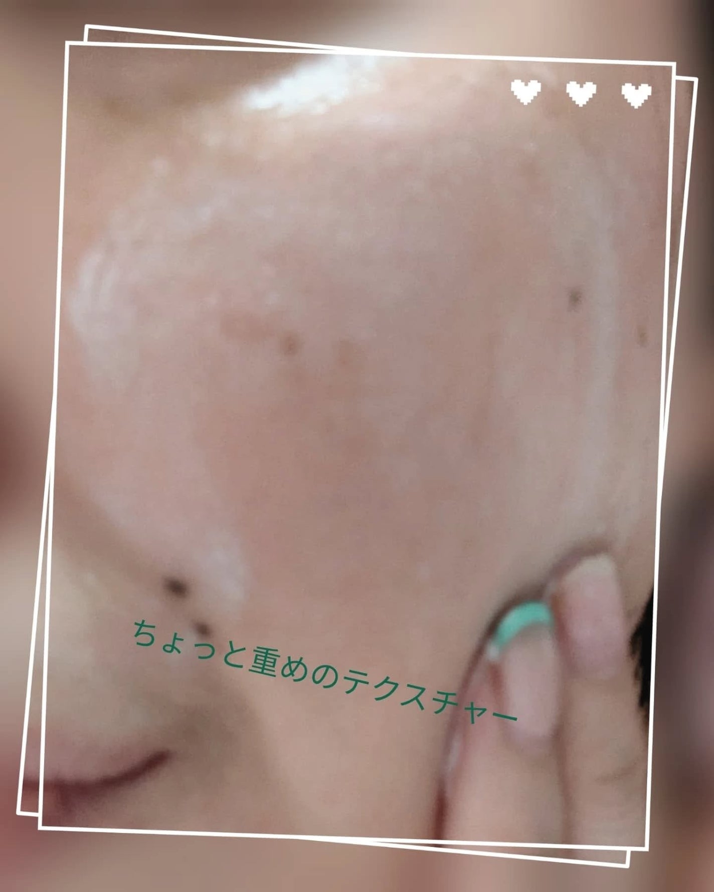 PDRN+リードルS 100/VT/美容液を使ったクチコミ(6枚目)