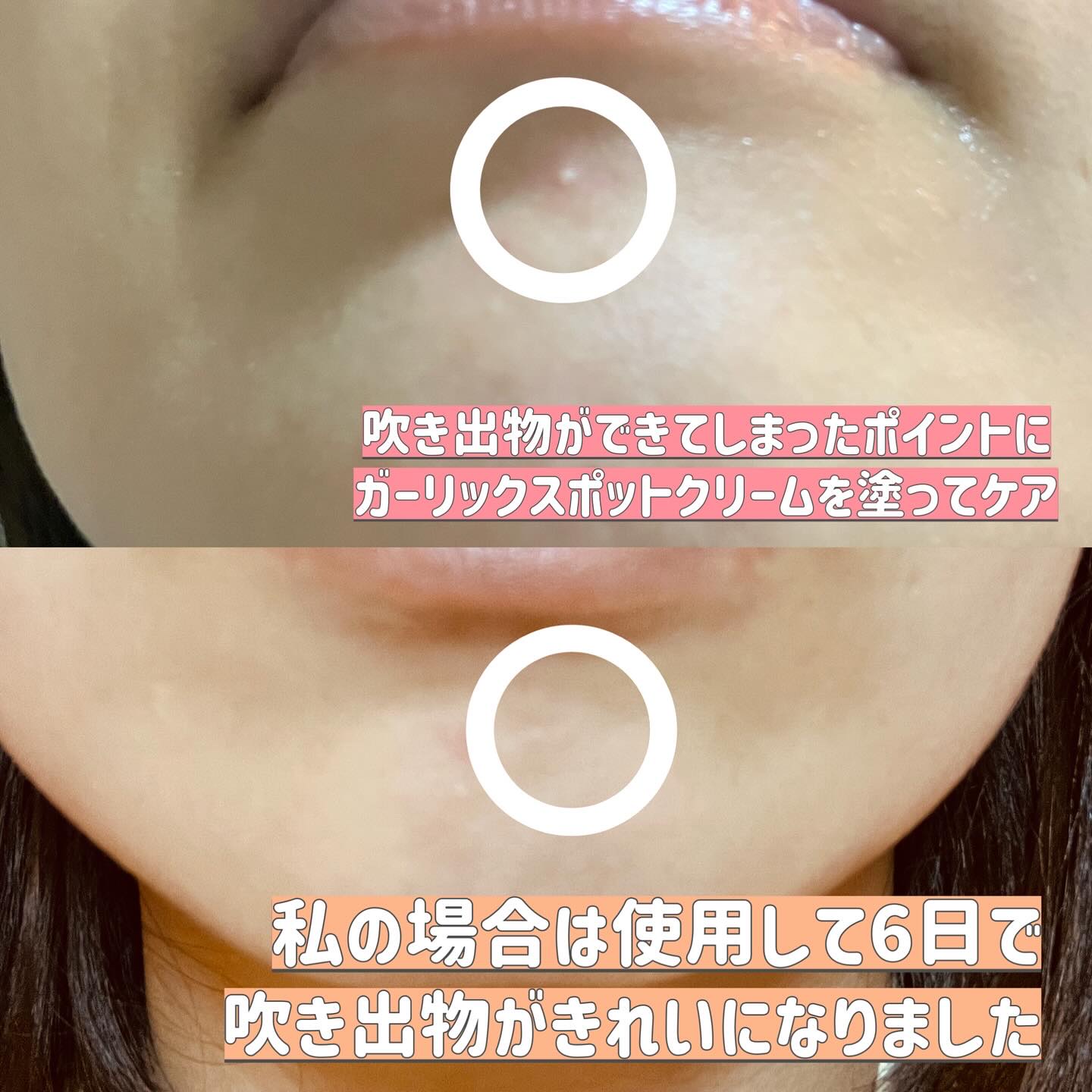 AZケア クレンジングオイル/VT/オイルクレンジングを使ったクチコミ（3枚目）