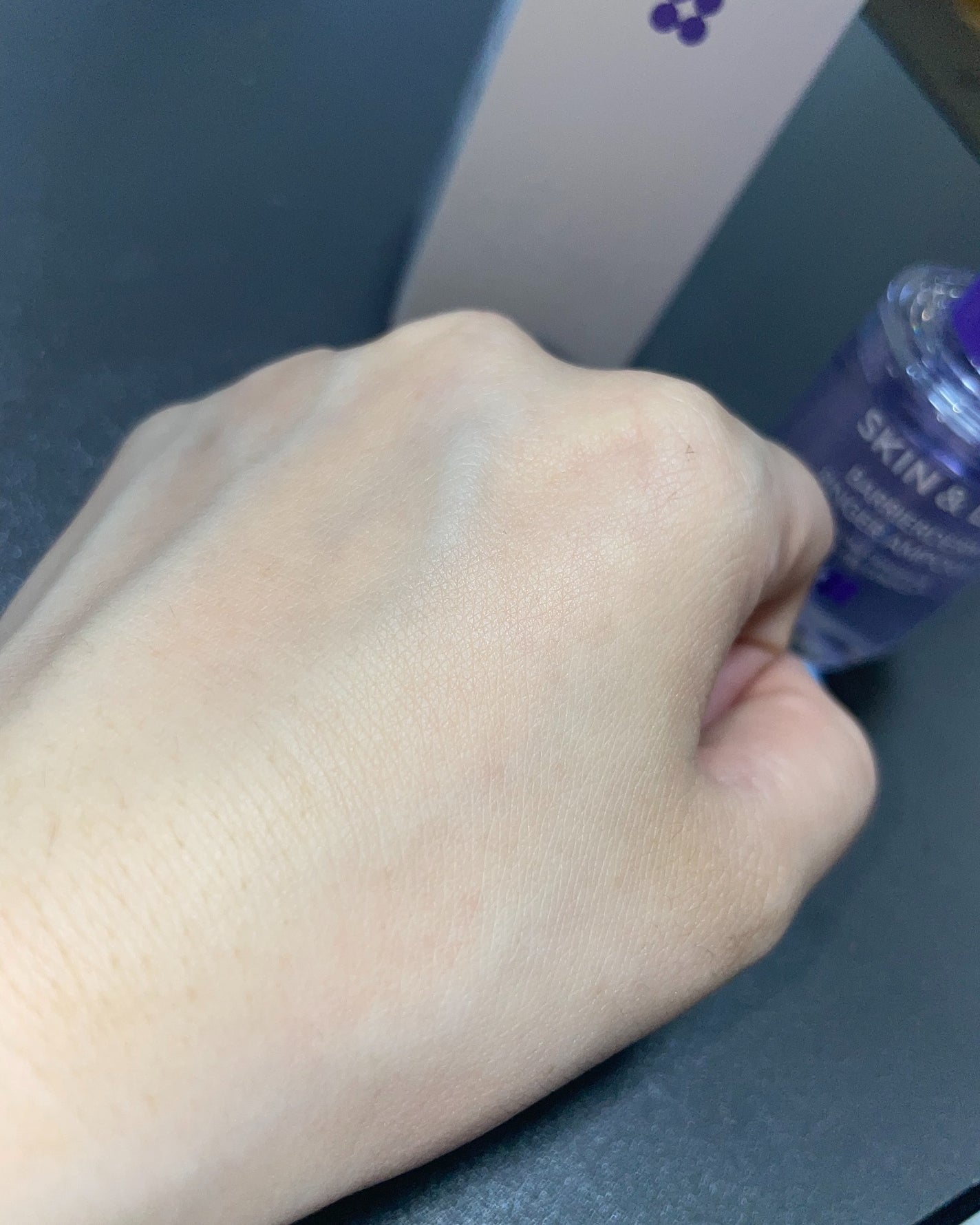 バリアダームリンガーアンプル/SKIN&LAB/美容液を使ったクチコミ(5枚目)