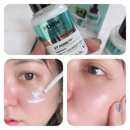 PDRN+リードルS 100/VT/美容液を使ったクチコミ(4枚目)