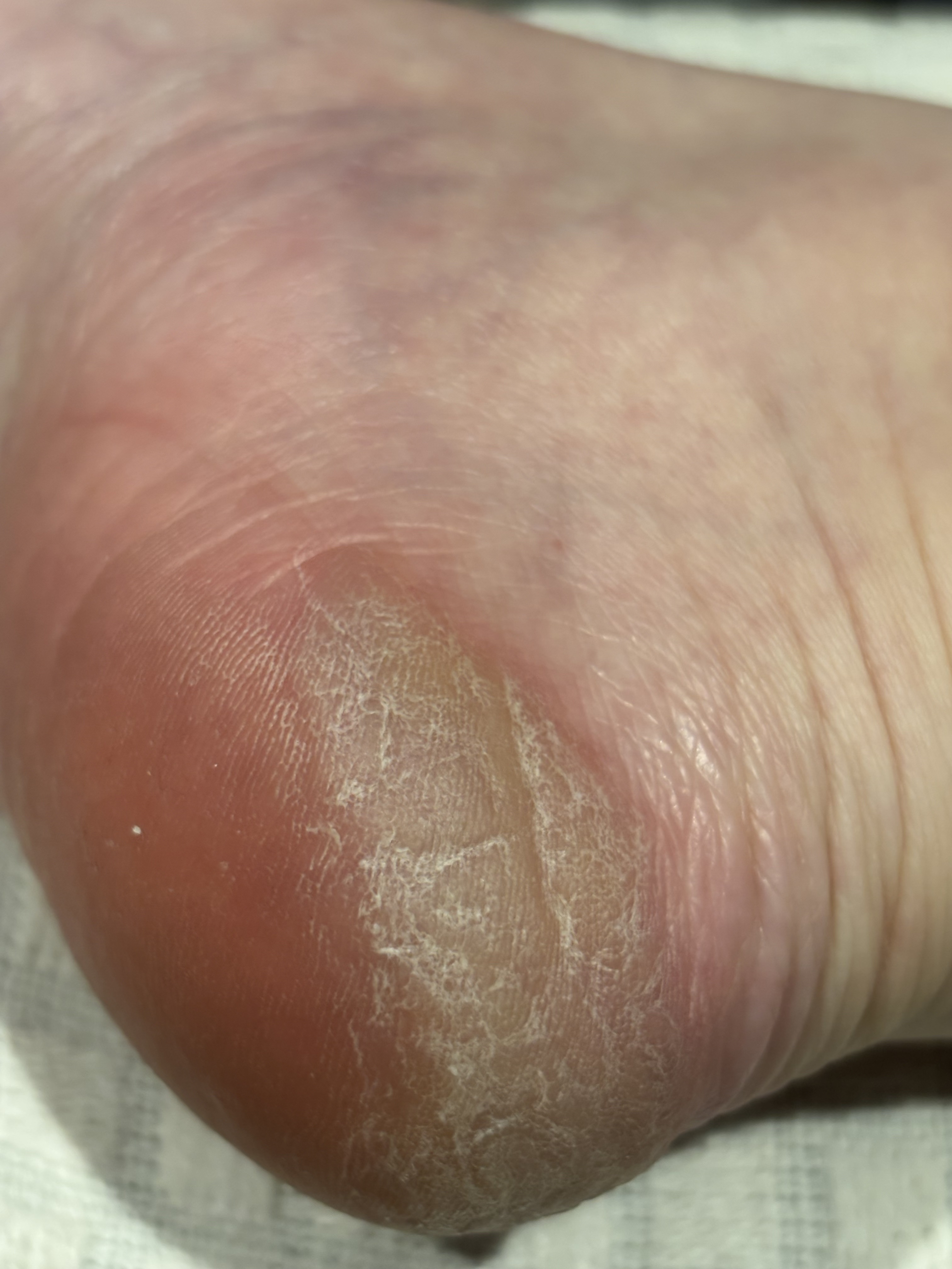 フットケアローション/SpaLuce/ミスト状化粧水を使ったクチコミ（2枚目）