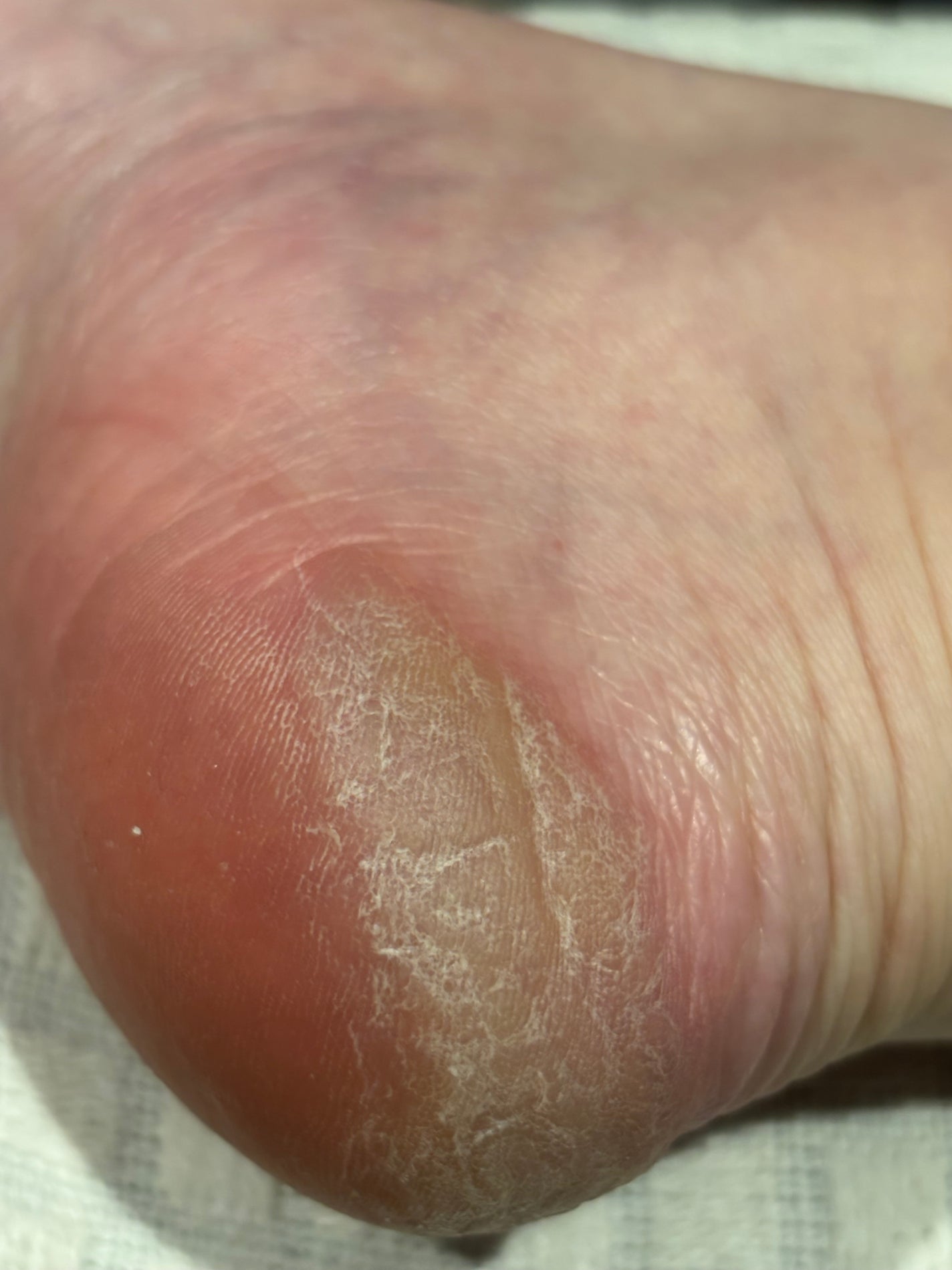 フットケアローション/SpaLuce/ミスト状化粧水を使ったクチコミ(2枚目)