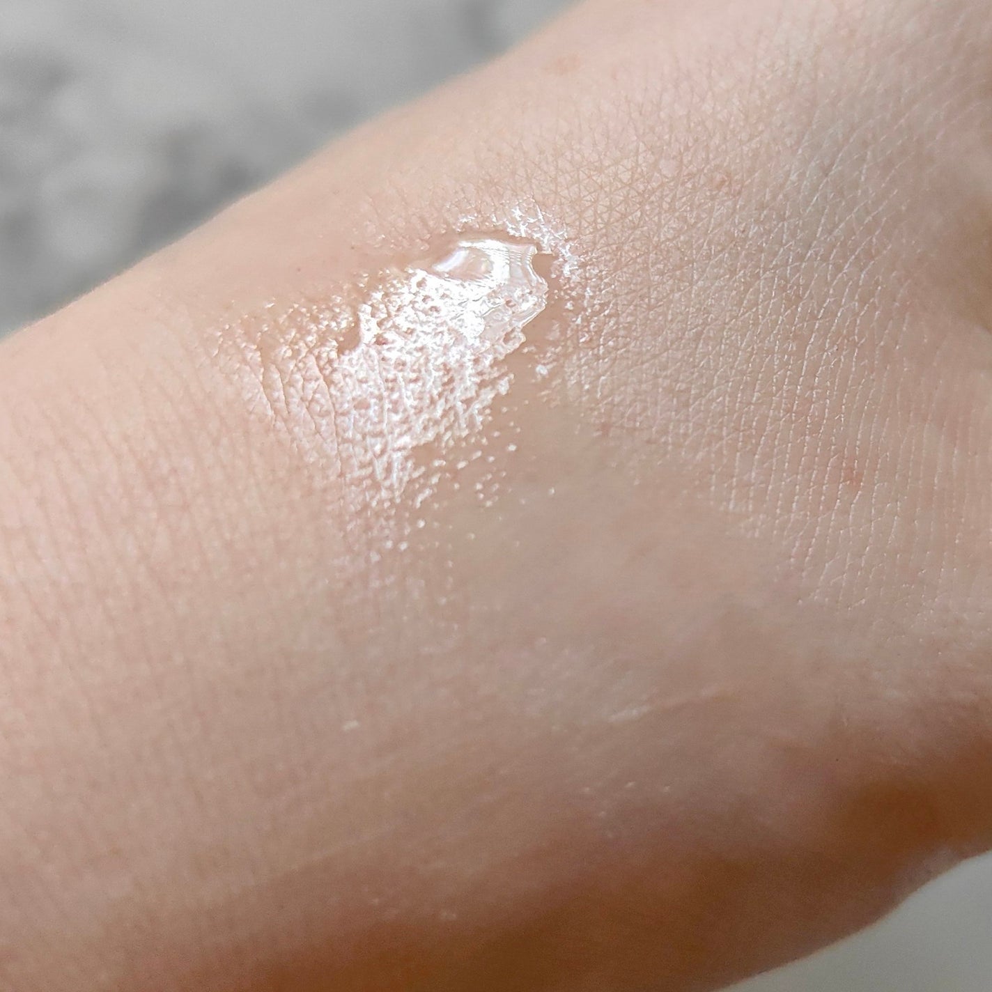 薬用 メディカル アンチヘアロスセラム/L'OCCITANE/頭皮ローションを使ったクチコミ(4枚目)