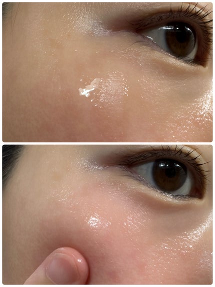 ウルトラリフティングEGFアンプル/LANBELLE/美容液を使ったクチコミ(5枚目)