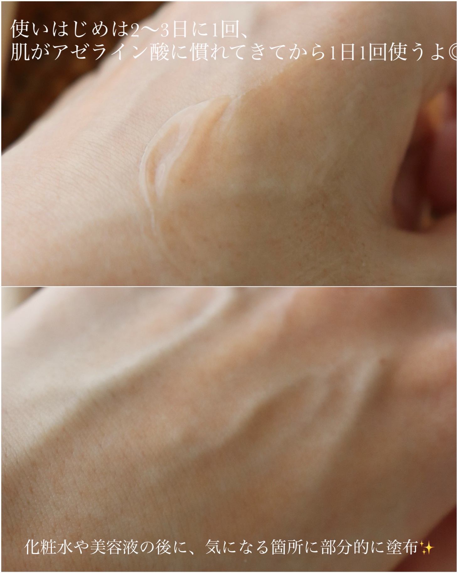 ACクリーム/LEPOREM/フェイスクリームを使ったクチコミ（3枚目）