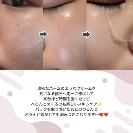 アンチリンクルエフェクトアンプルオリジン/MIGUHARA/美容液を使ったクチコミ(5枚目)