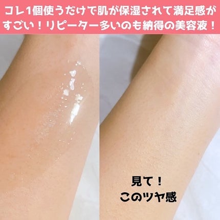 リンクル O/L コンセントレート/DECENCIA/美容液を使ったクチコミ(4枚目)