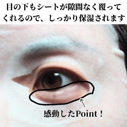 ルルルン ハイドラ V マスク/ルルルン/シートマスク・パックを使ったクチコミ(5枚目)