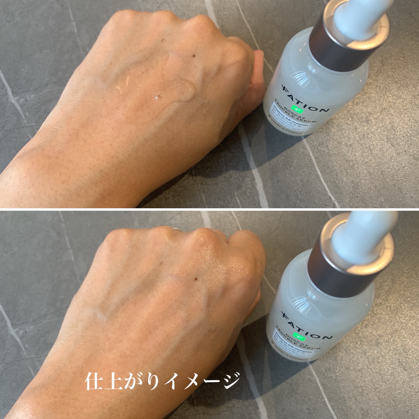 ノスカナイン トラブルクリーム/FATION/フェイスクリームを使ったクチコミ（2枚目）