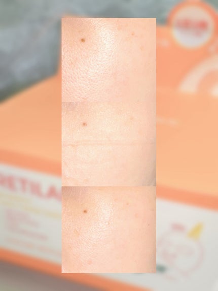 レチララ デイリーシートマスク/ネイチャーリパブリック/シートマスク・パックを使ったクチコミ(5枚目)