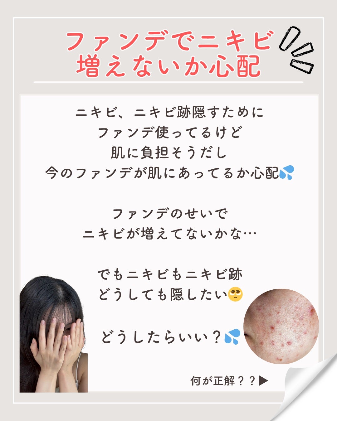 ニキビを諦めかけた人の味方|エマ🫧 on LIPS 「ニキビ跡があるから、「ファンデを塗らないと外に出られない」でも..」(2枚目)