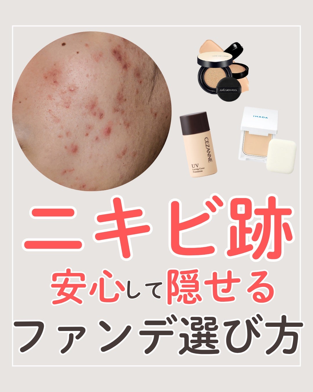 ニキビを諦めかけた人の味方|エマ🫧 on LIPS 「ニキビ跡があるから、「ファンデを塗らないと外に出られない」でも..」(1枚目)