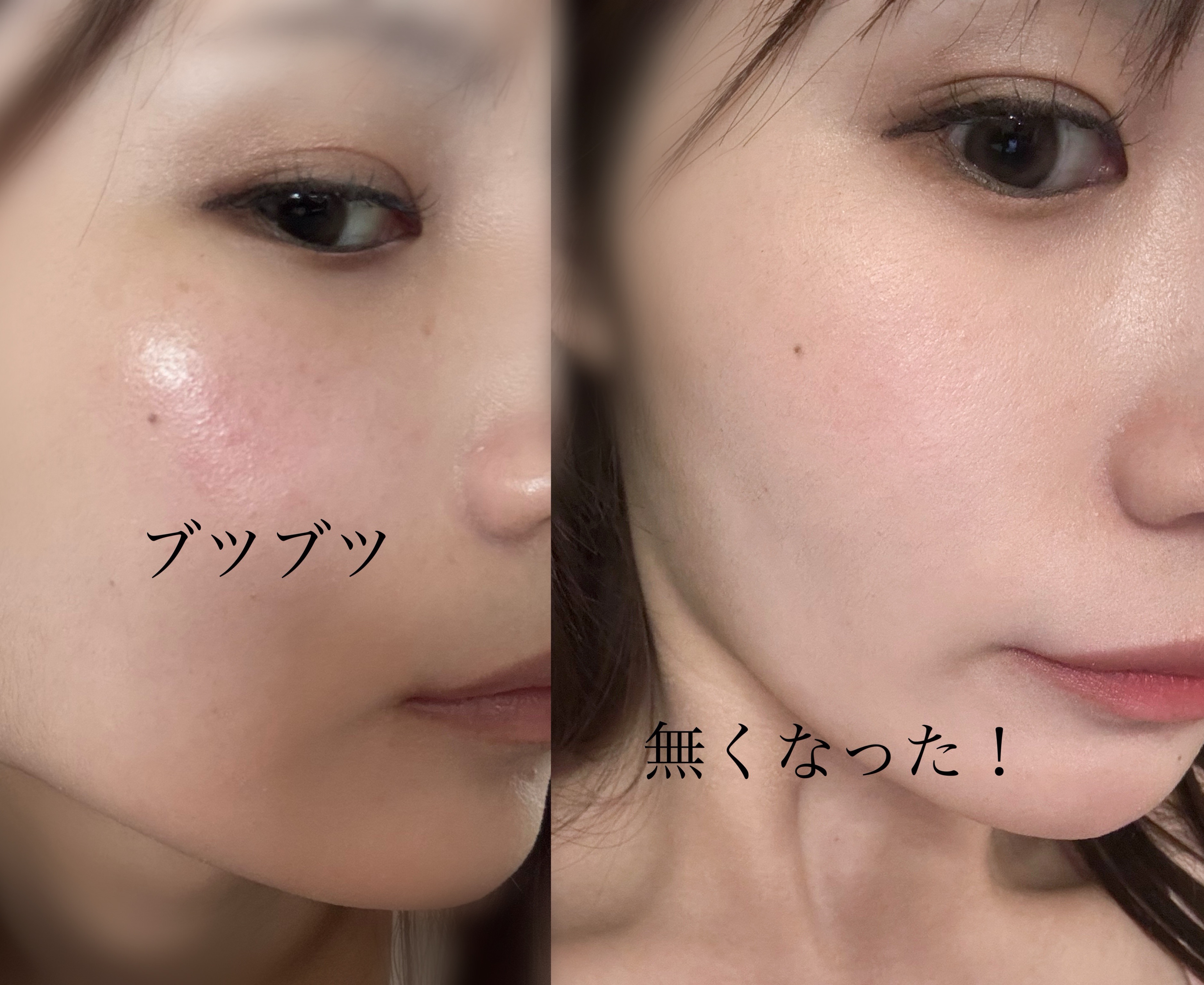 ナチュラルアクアジェル/Cure/ピーリングを使ったクチコミ（1枚目）