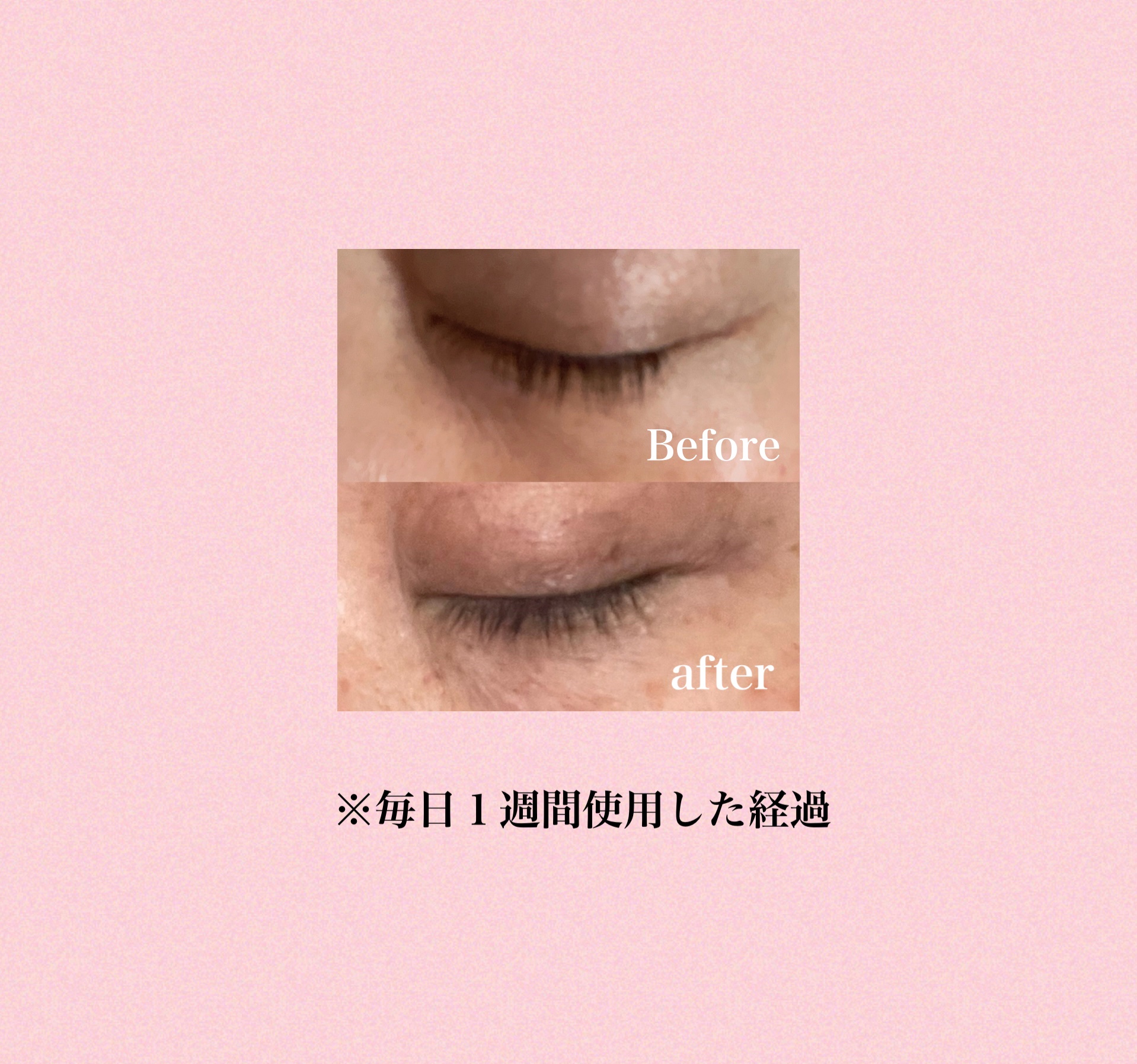 リアルミービオテノールラッシュアップアンプル/ベリサム/まつげ美容液を使ったクチコミ（3枚目）