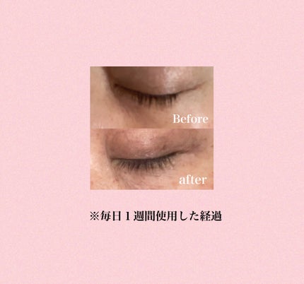リアルミービオテノールラッシュアップアンプル/ベリサム/まつげ美容液を使ったクチコミ(3枚目)