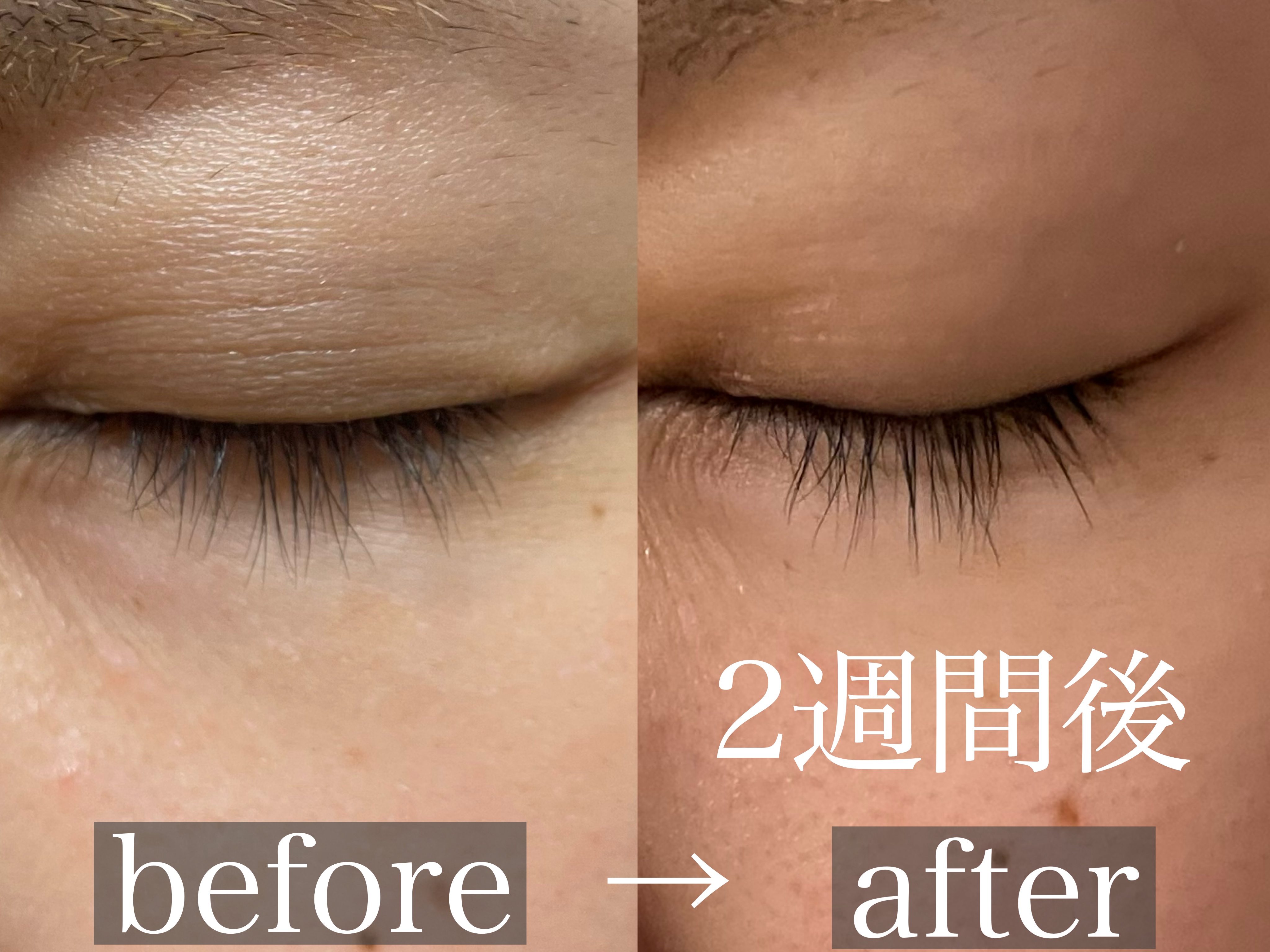 アイラッシュエッセンシャルセラム/epais/まつげ美容液を使ったクチコミ（3枚目）