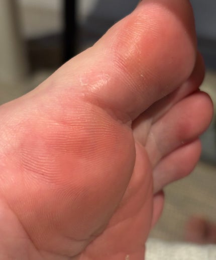 フットケアローション/SpaLuce/ミスト状化粧水を使ったクチコミ(4枚目)