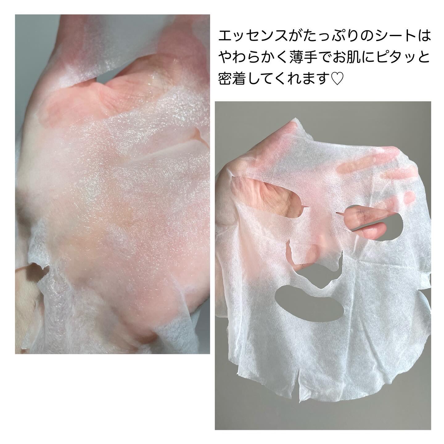 マデカッソシド ブレミッシュマスク/MEDIHEAL/シートマスク・パックを使ったクチコミ（3枚目）